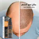 بخاخ نمو الشعر hair growth spray