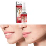 ⁦سيرم مزيل حبوب الشباب و الظهر و ترطيب الجسم⁩ - الصورة ⁦2⁩