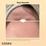 ⁦CORSX Snail serum⁩ - الصورة ⁦2⁩