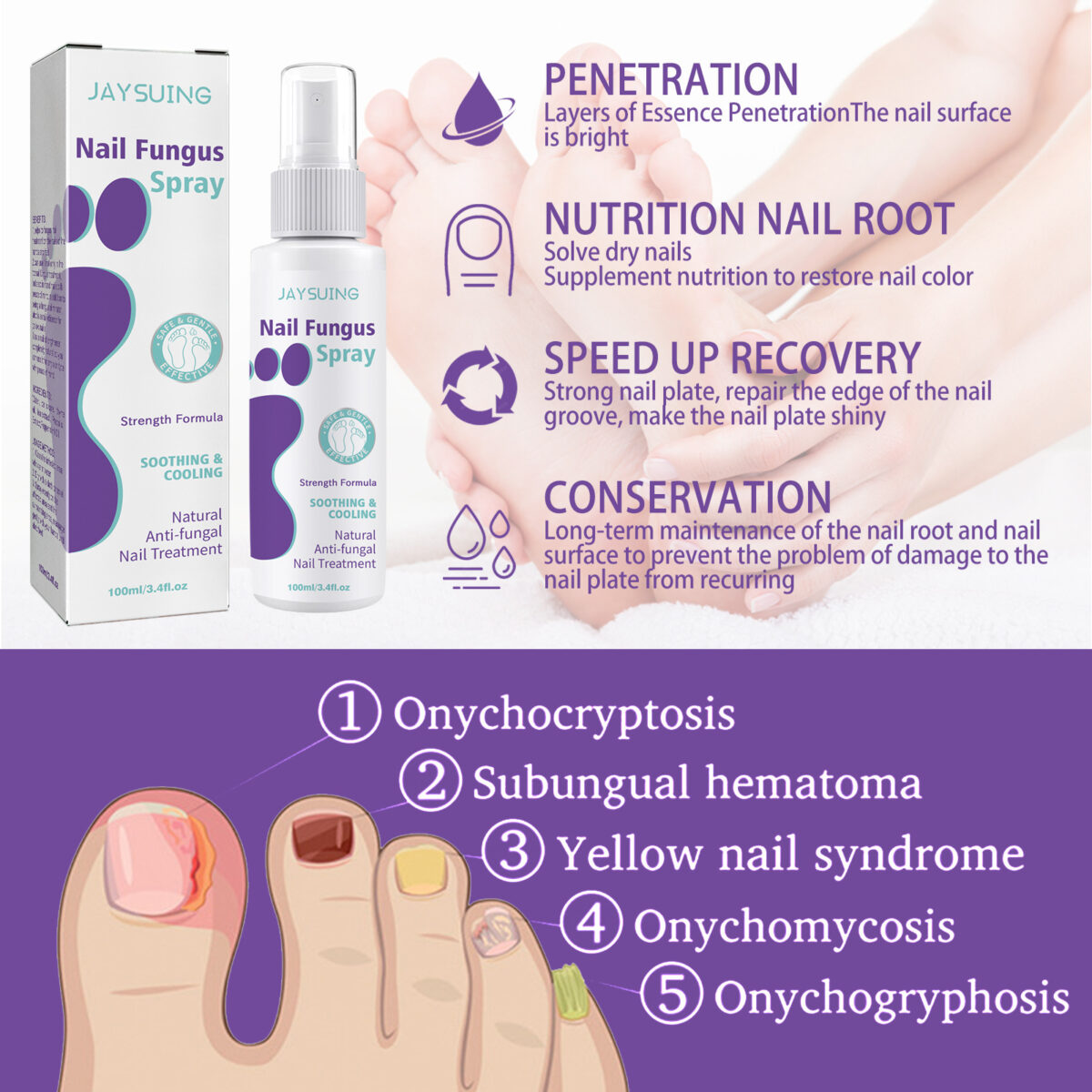 ⁦• NAIL FANGUS SPRAY⁩ - الصورة ⁦13⁩