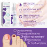 ⁦• NAIL FANGUS SPRAY⁩ - الصورة ⁦7⁩