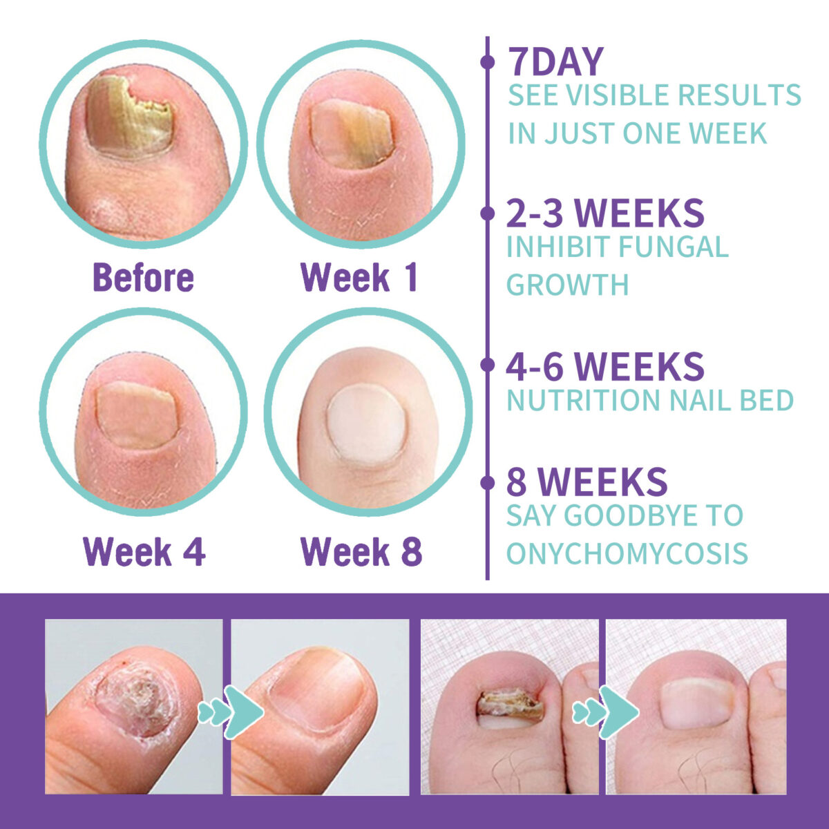 ⁦• NAIL FANGUS SPRAY⁩ - الصورة ⁦5⁩