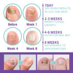 ⁦• NAIL FANGUS SPRAY⁩ - الصورة ⁦5⁩