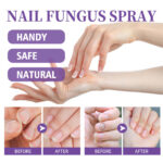 ⁦• NAIL FANGUS SPRAY⁩ - الصورة ⁦14⁩