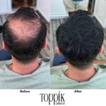 ⁦عرض عبوتين Toppik Hair Fibers لفراغات الشعر ( اللون اسود )⁩ - الصورة ⁦3⁩