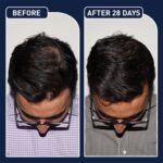 ⁦عرض سيرم Blue PePtide + سبراي الشعر FEG⁩ - الصورة ⁦4⁩